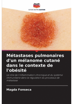 Métastases pulmonaires d'un mélanome cutané dans le contexte de l'obésité
