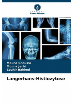 Langerhans-Histiozytose
