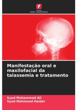 Manifestação oral e maxilofacial da talassemia e tratamento