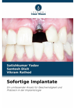 Sofortige Implantate