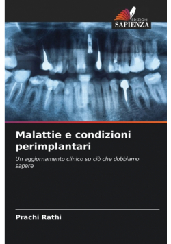 Malattie e condizioni perimplantari