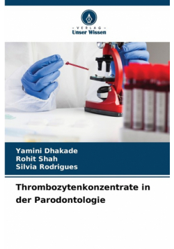 Thrombozytenkonzentrate in der Parodontologie