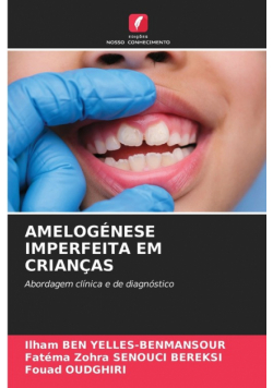 Amelogénese Imperfeita Em Crianças