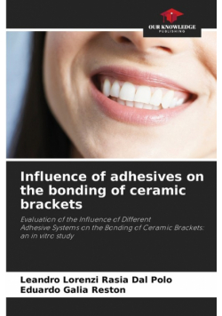Influence of adhesives on the bonding of ceramic brackets