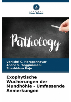 Exophytische Wucherungen der Mundhöhle - Umfassende Anmerkungen