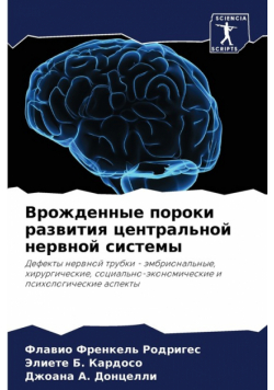 Врожденные пороки развития центральной нервной системы