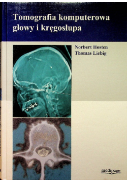 Tomografia Komputerowa Głowy i Kręgosłupa