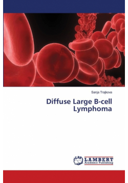 Diffuse Large B-cell Lymphoma