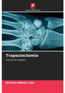 Trapeziectomia