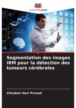 Segmentation des images IRM pour la détection des tumeurs cérébrales