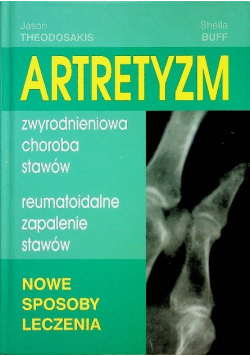 Artretyzm Zwyrodnieniowa choroba stawów Reumatoidalne zapalenie stawów