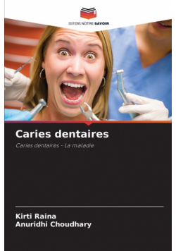 Caries dentaires