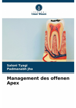 Management des offenen Apex