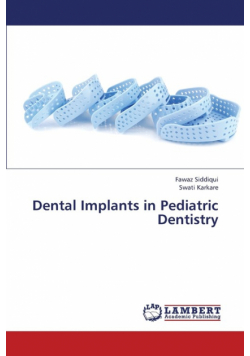 Dental Implants in Pediatric Dentistry