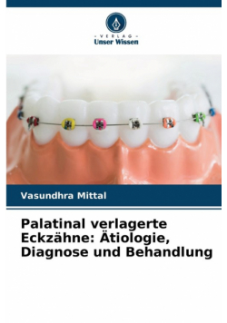 Palatinal verlagerte Eckzähne