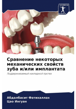 Сравнение некоторых механических свойств зуба и/или имплантата