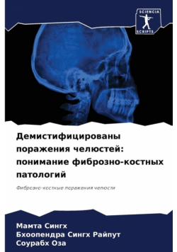 Демистифицированы поражения челюстей