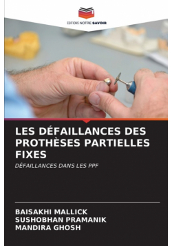 Les Défaillances Des Prothèses Partielles Fixes