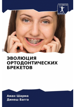 ЭВОЛЮЦИЯ ОРТОДОНТИЧЕСКИХ БРЕКЕТОВ