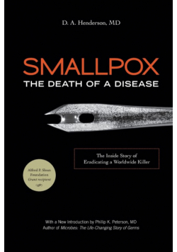 Smallpox
