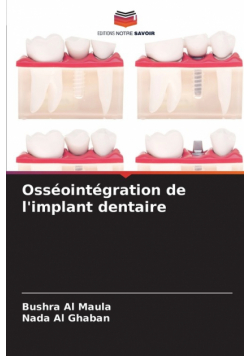 Osséointégration de l'implant dentaire