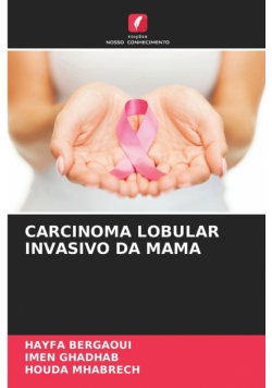 Carcinoma Lobular Invasivo Da Mama