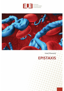 Epistaxis