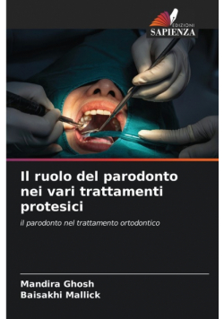Il ruolo del parodonto nei vari trattamenti protesici
