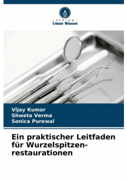Ein praktischer Leitfaden für Wurzelspitzen- restaurationen