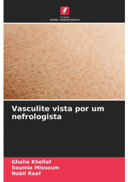 Vasculite vista por um nefrologista