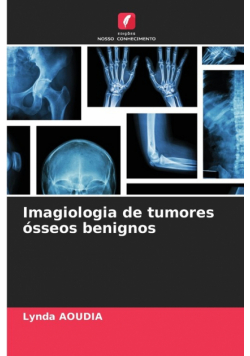 Imagiologia de tumores ósseos benignos