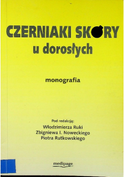 Czerniak skóry u dorosłych