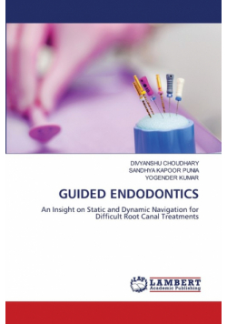 Guided Endodontics