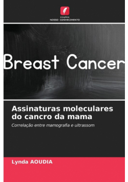 Assinaturas moleculares do cancro da mama