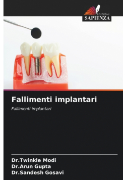 Fallimenti implantari