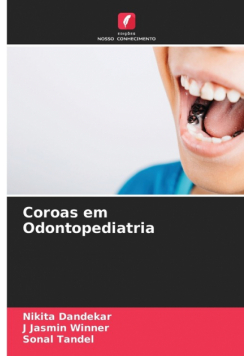 Coroas em Odontopediatria