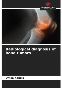 Radiological diagnosis of bone tumors