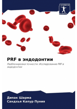 Prf В Эндодонтии