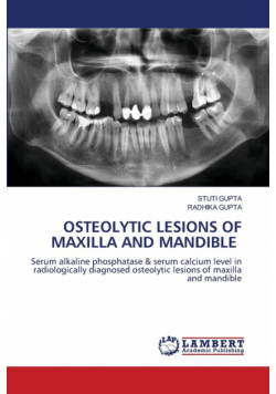 Osteolytic Lesions Of Maxilla And Mandible