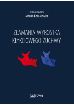 Złamania wyrostka kłykciowego żuchwy
