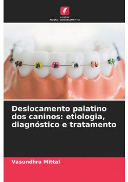 Deslocamento palatino dos caninos