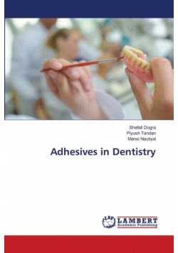 Adhesives in Dentistry