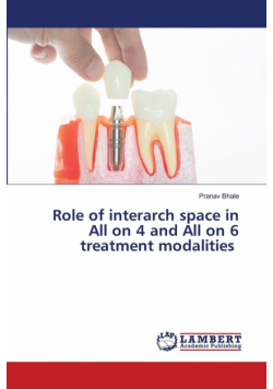 Role of interarch space in All on 4 and All on 6 treatment modalities