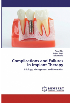 Complications and Failures in Implant Therapy