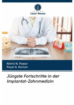 Jüngste Fortschritte in der Implantat-Zahnmedizin