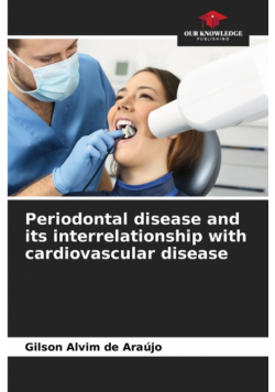Periodontal disease and its interrelationship with cardiovascular disease