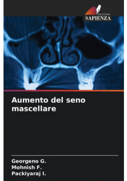 Aumento del seno mascellare