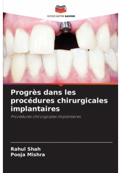 Progrès dans les procédures chirurgicales implantaires