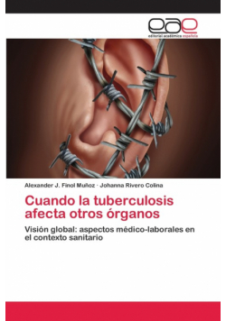 Cuando la tuberculosis afecta otros órganos