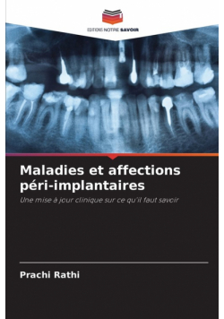 Maladies et affections péri-implantaires